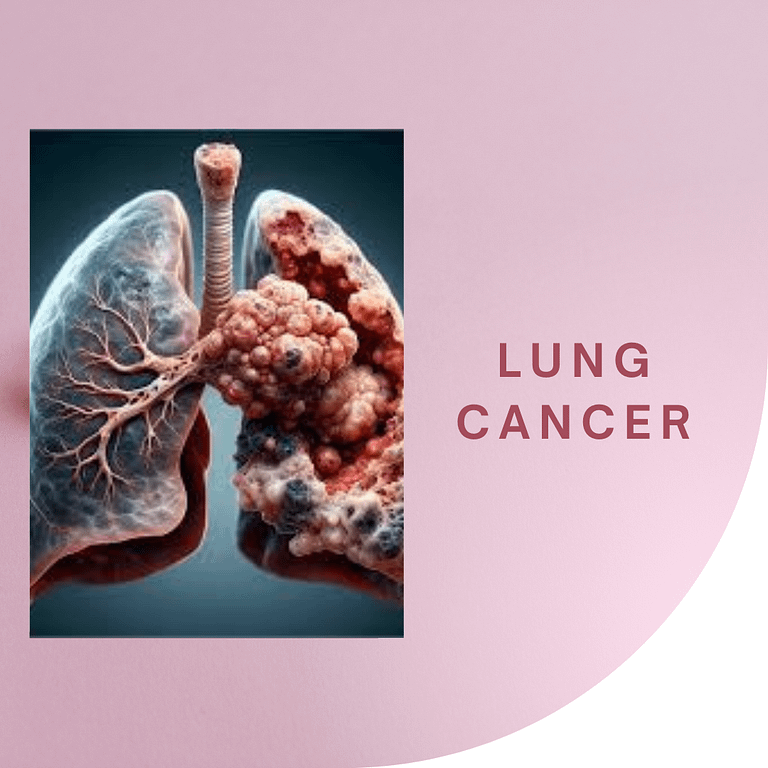 Recent Advances in Lung Cancer Research: A Comprehensive Overview